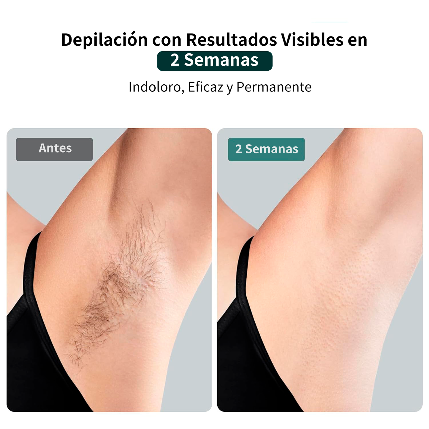 JOVS X™ 3-in-1 IPL Hair Removal Device