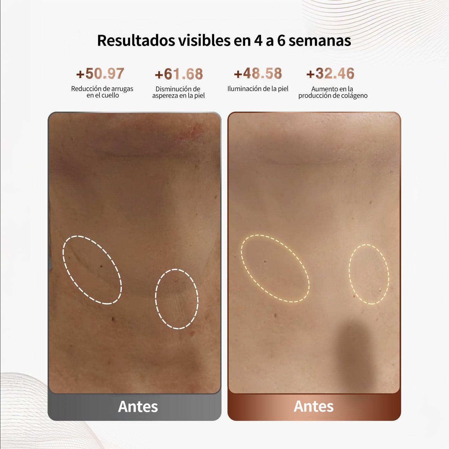 Máscara LED para cuello y escote