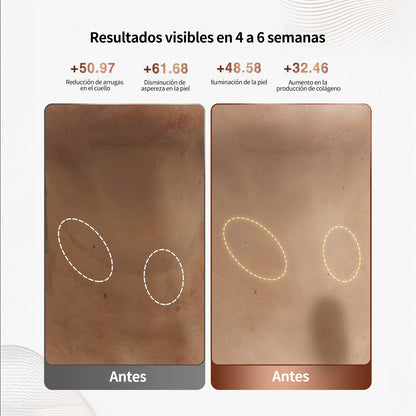 Máscara LED para cuello y escote