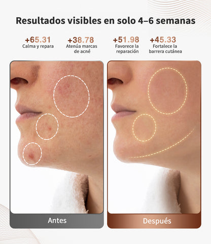 Máscara Facial de Terapia de Luz LED