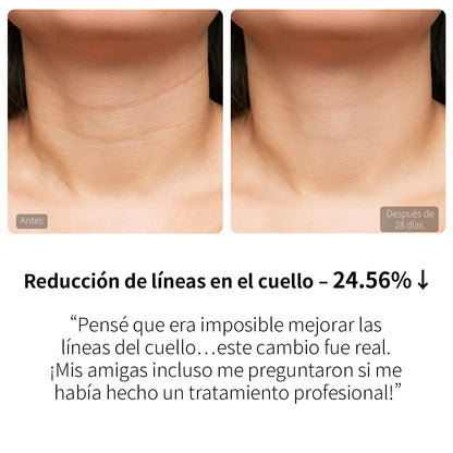 EMS SHORTS + MÁSCARA DE CUELLO