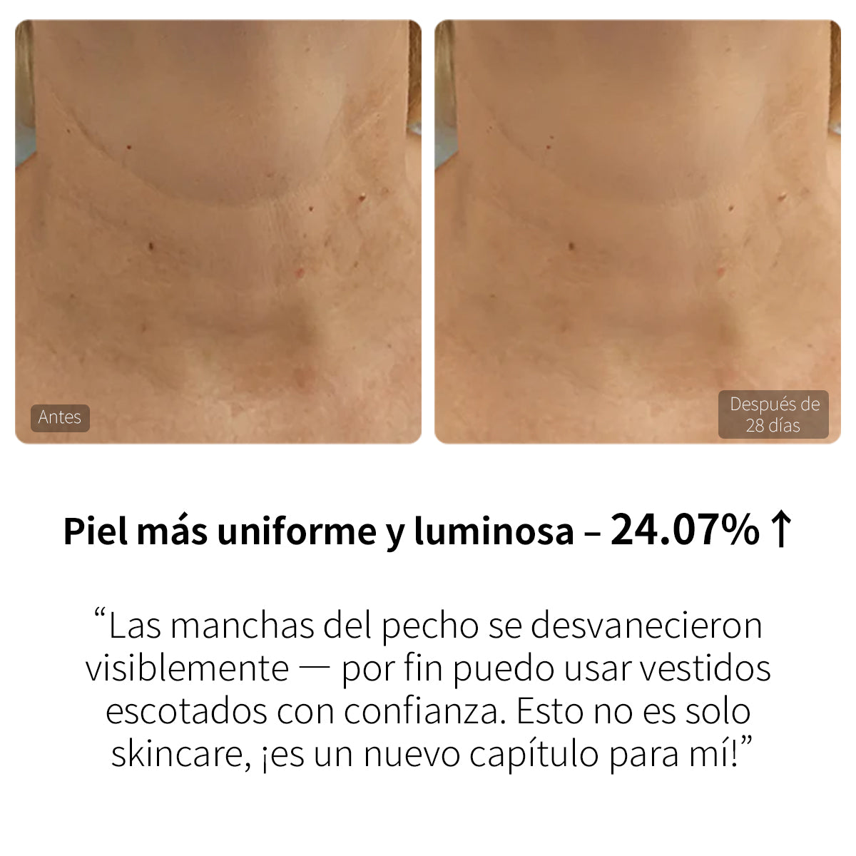 EMS SHORTS + MÁSCARA DE CUELLO