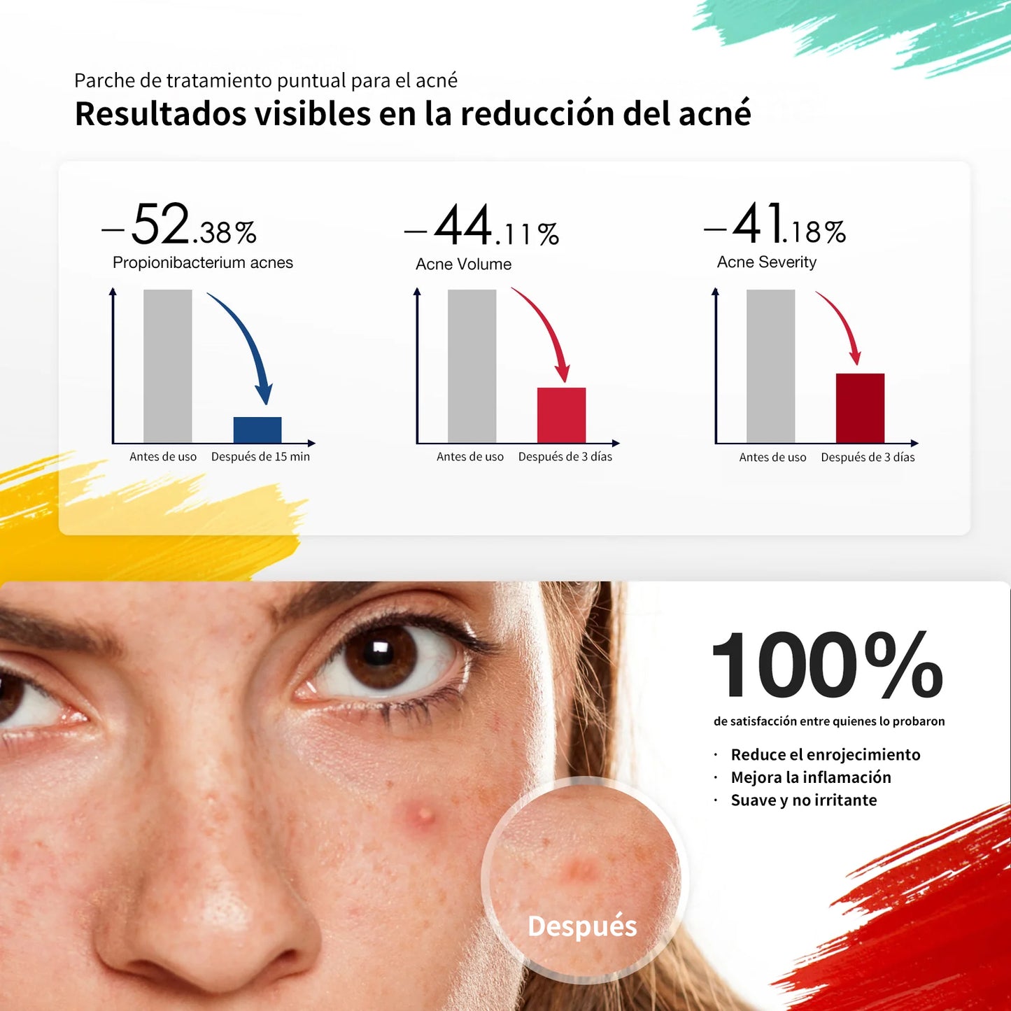 JOVS AcneBYE™ - Tratamiento de Parche LED